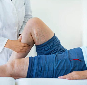 A clinician examining a patient's leg during a vein consultation.